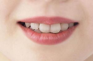 自然な二重まぶたを手に入れるための美容整形完全ガイド：施術の安全性とダウンタイムを徹底解説！